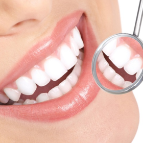 Bọc răng sứ khắc phục khuyết điểm về răng mang lại nụ cười rạng rỡ